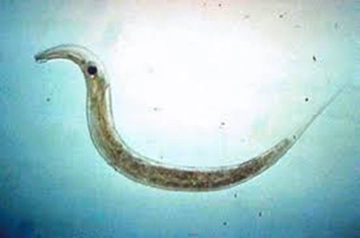 Kıl Kurdu Belirtileri ve Tedavisi